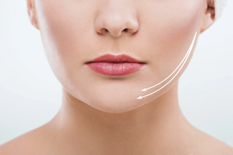 如何安全有效消除雙下巴？